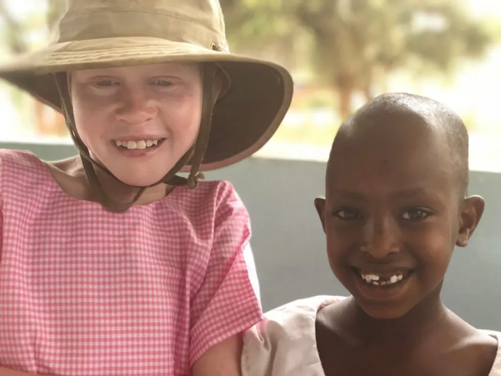Upendo with albinism is smiling standing next to her friend